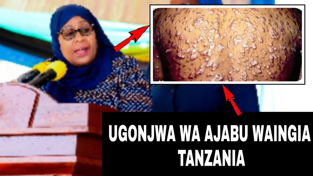 🔴LIVE :RAIS SAMIA ATANGAZA UGONJWA WA AJABU UME INGIA TANZANIA/ unatesa sana