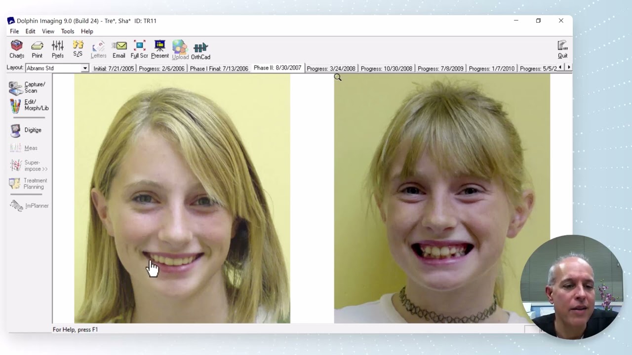 ARA Ortho Case Of The Week - Phase I & II Treatment