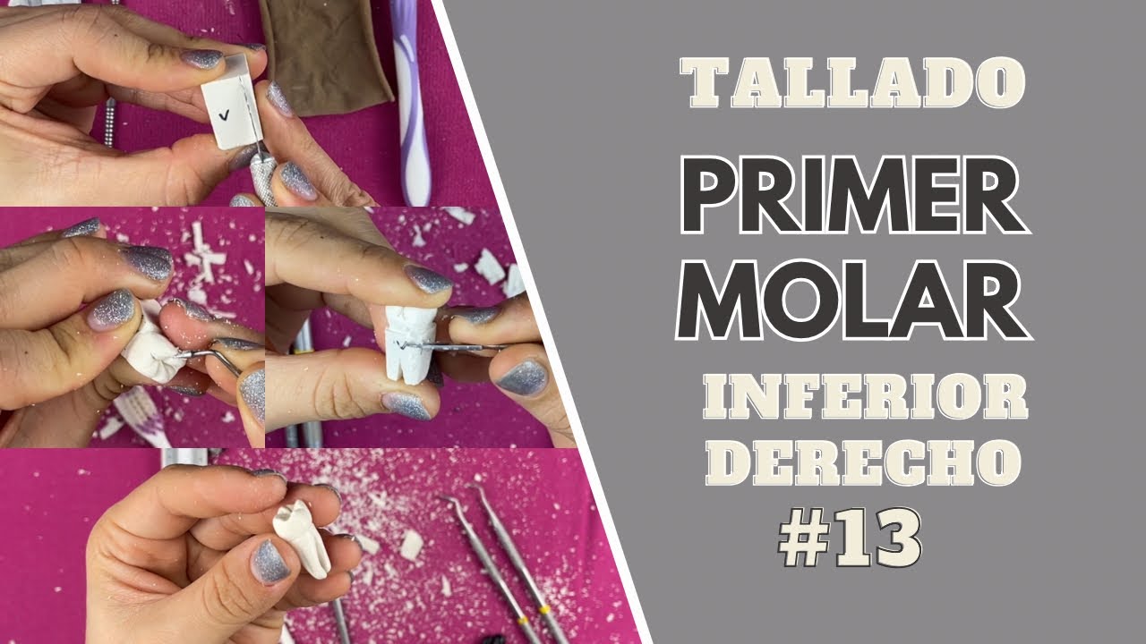 Tallado en cera de primer molar inferior derecho | Odontologia Con Cri