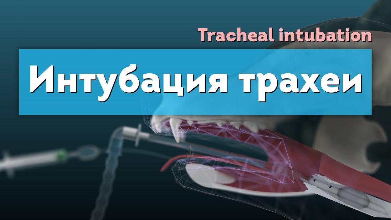 Интубация трахеи. Tracheal intubation 3D