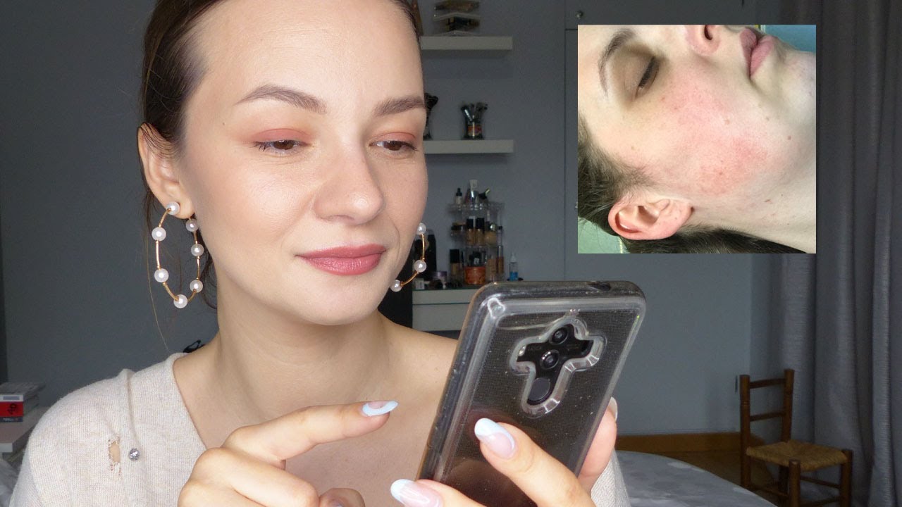 AIDE MOI AURELIE : fond de teint poudre, érythrose et cernes brunes #5