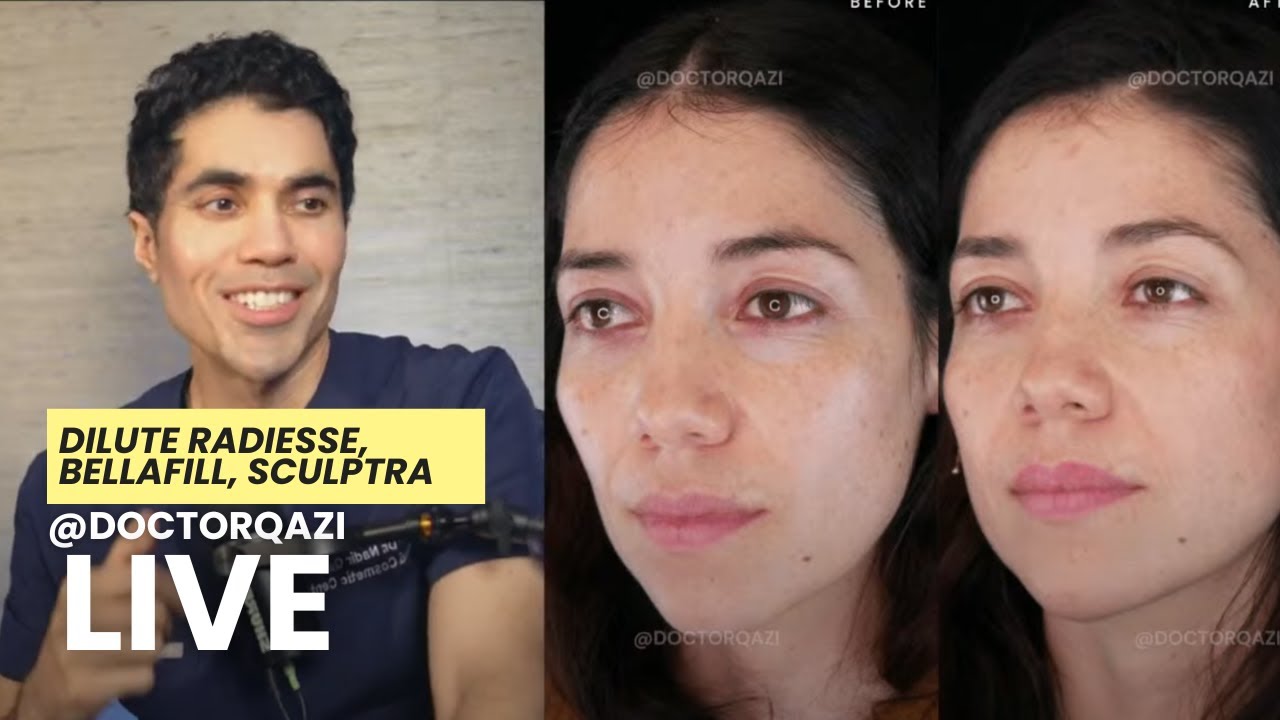 Доктор А.С. Кази рассказывает о Dilute Radiance, Bellafill и Sculptra | Неспонсируемый прямой эфи...