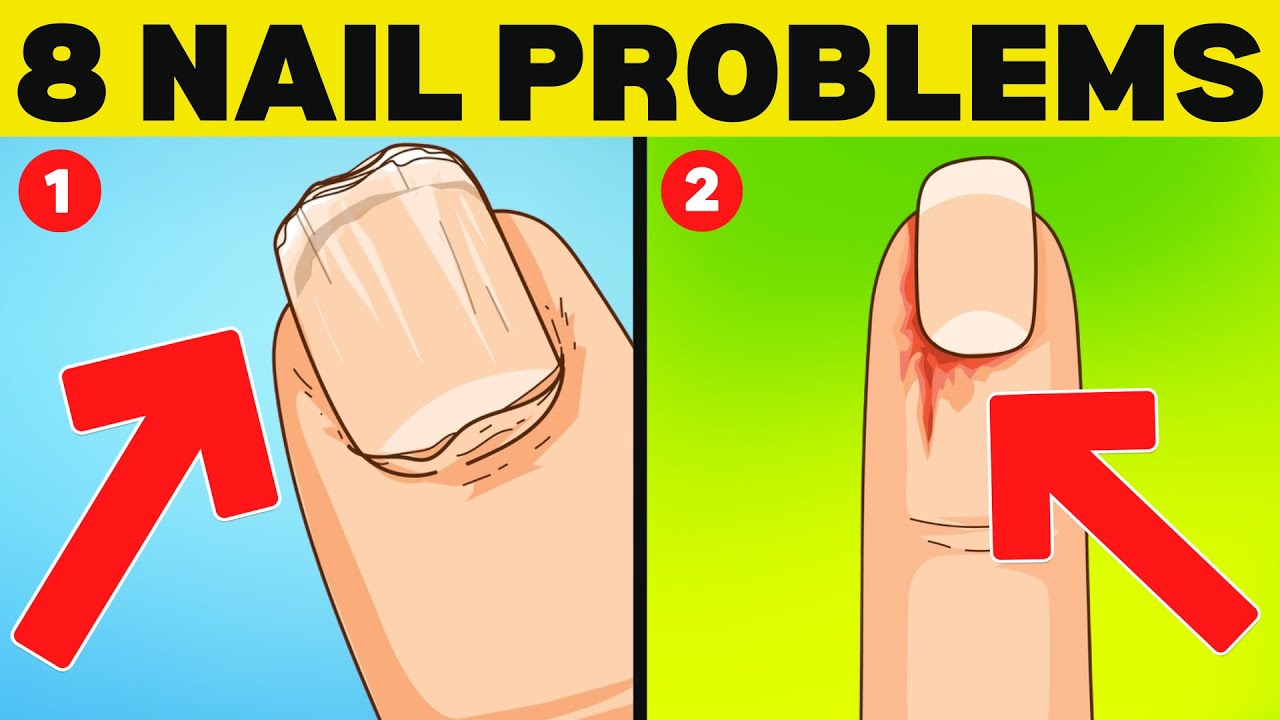 Top 8 Nail Signs of Health Problems (Uncovering The Causes)