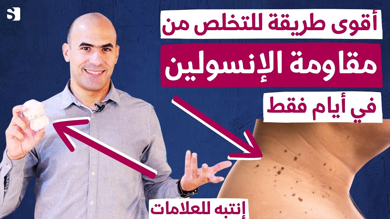 اقوى طريقة لعلاج مقاومة الانسولين في ايام فقط | احذر قبل ان تصبح مريض سكري