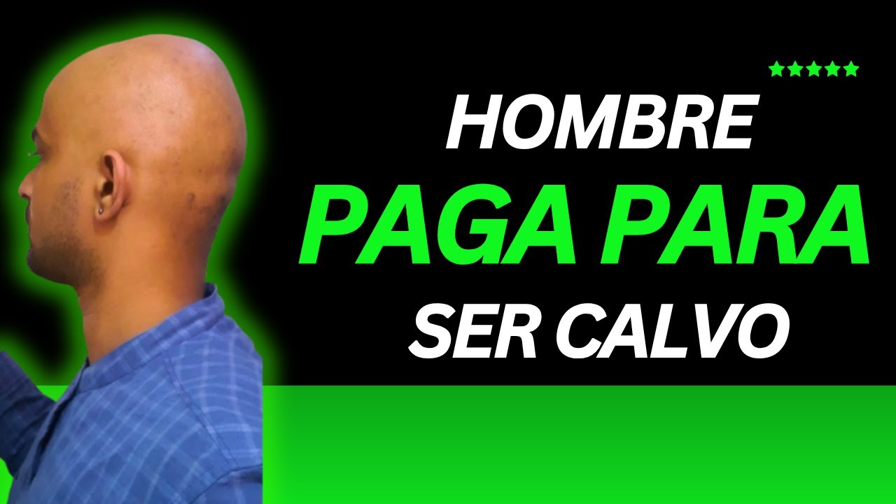 HOMBRE SIN ALOPECIA PAGA PARA SER CALVO ¿POR QUÉ?