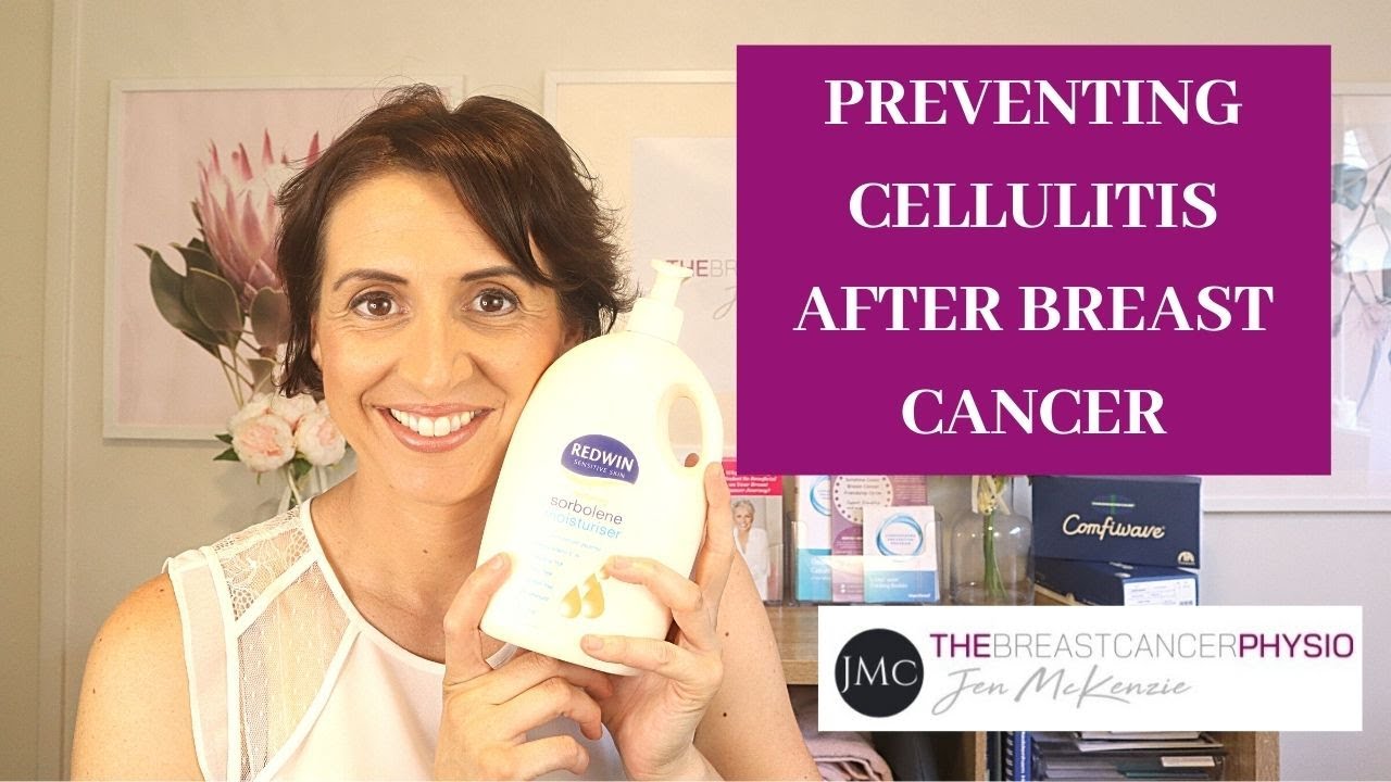 PREVENTING CELLULITIS AFTER BREAST CANCER | Infection risk after lymph node removal or radiation