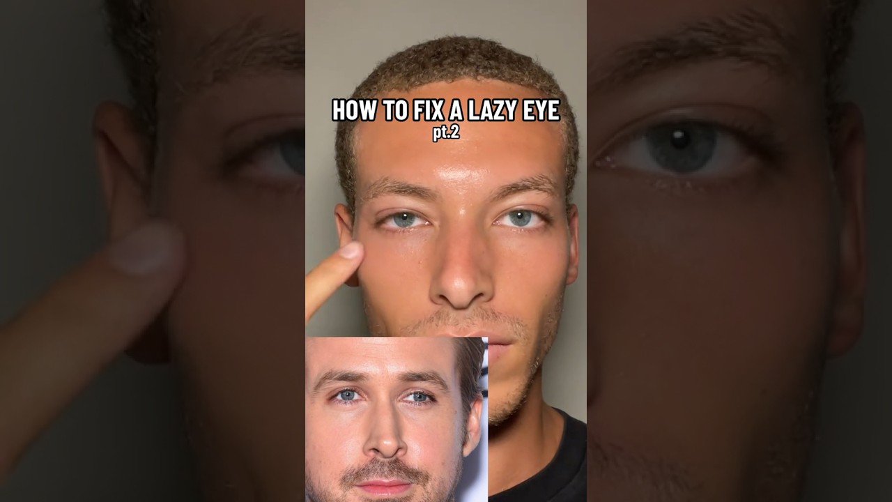 How to fix a lazy eye pt.2