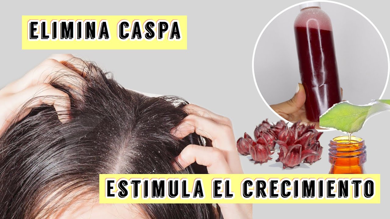 SHAMPOO POTENCIADO CON FLOR DE JAMAICA | #RetoCrecimiento - Jenn Lebron