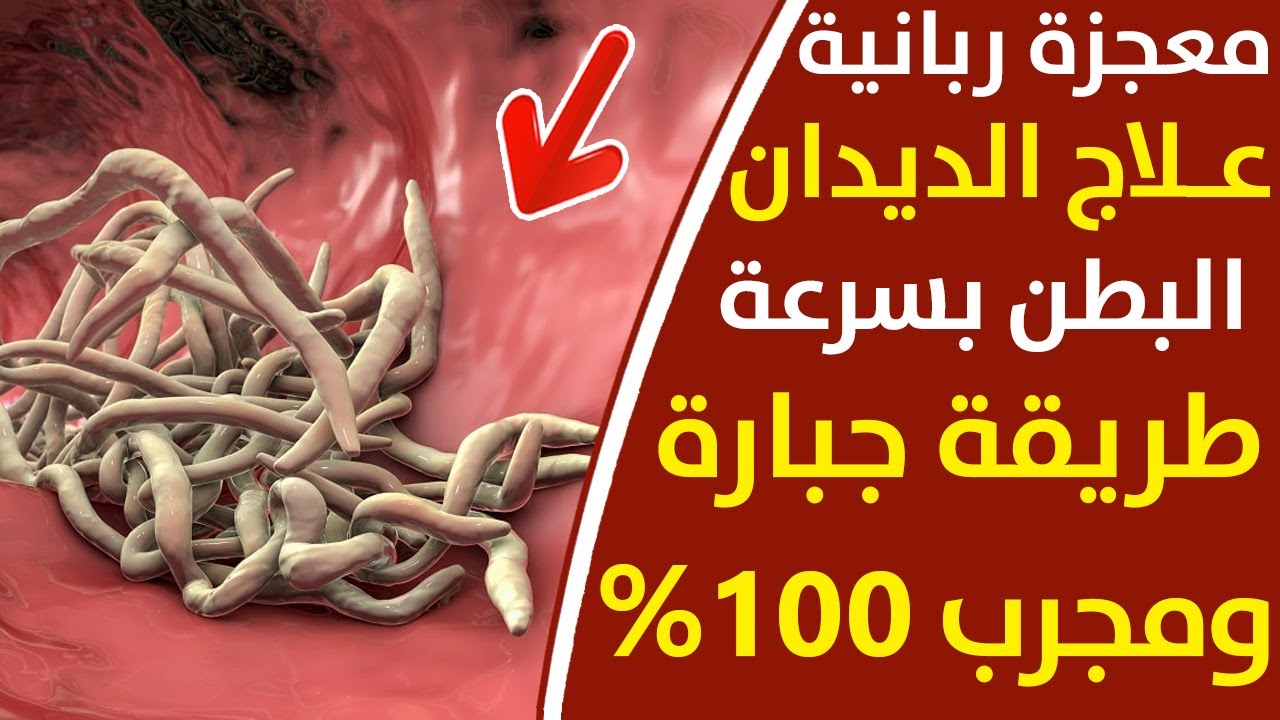 علاج الديدان البطن في المنزل بشكل نهائي بدون ادوية فوائد الثوم على الريق افضل طريقة لتخلص من الديدان