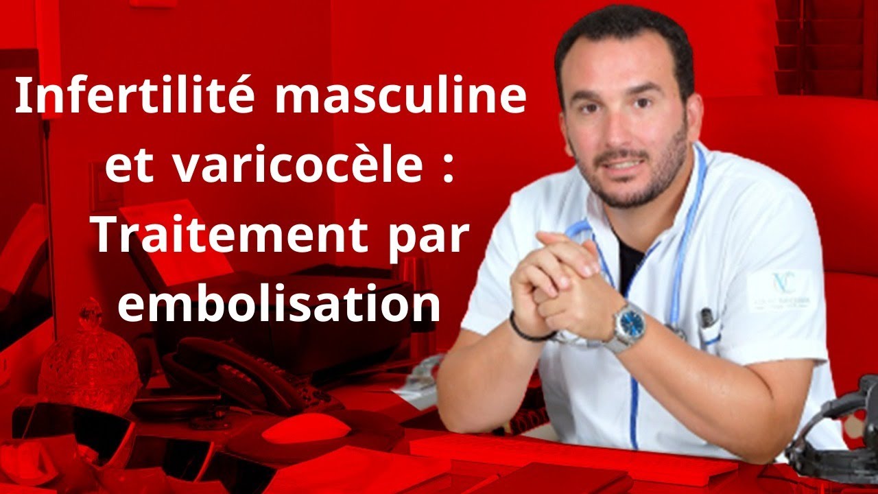 Embolisation de la varicocèle : une technique indolore avec le taux de réussite le plus élevé.