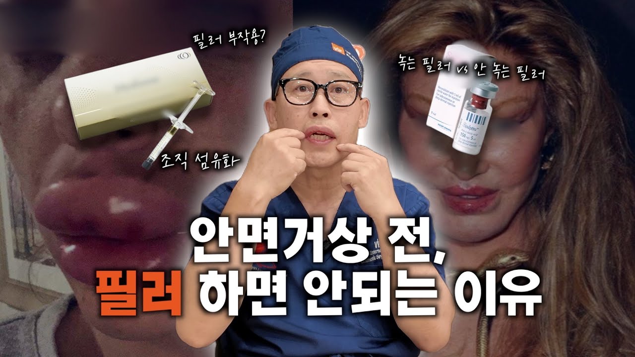 안면거상 앞두고 필러? 전문가가 말리는 이유 | VIP 성형외과