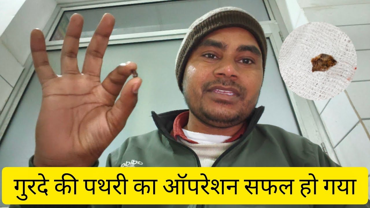 गुरदे की पथरी का ऑपरेशन सफल हो गया ✅