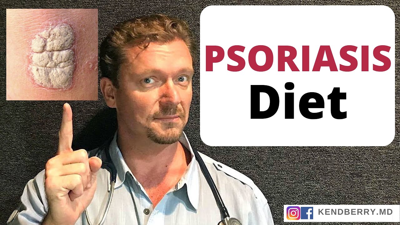 The Psoriasis Diet. Better than Medicine?? 2026