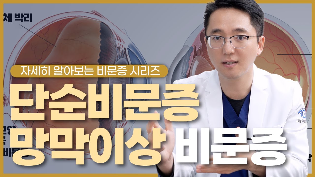 단순 비문증과 망막 이상으로 발전하는 비문증은 어떤 차이가 있을까?