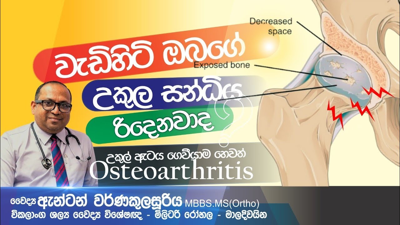 උකුල සන්ධිය ගෙවීයාම,Osteoarthritis of hip joint