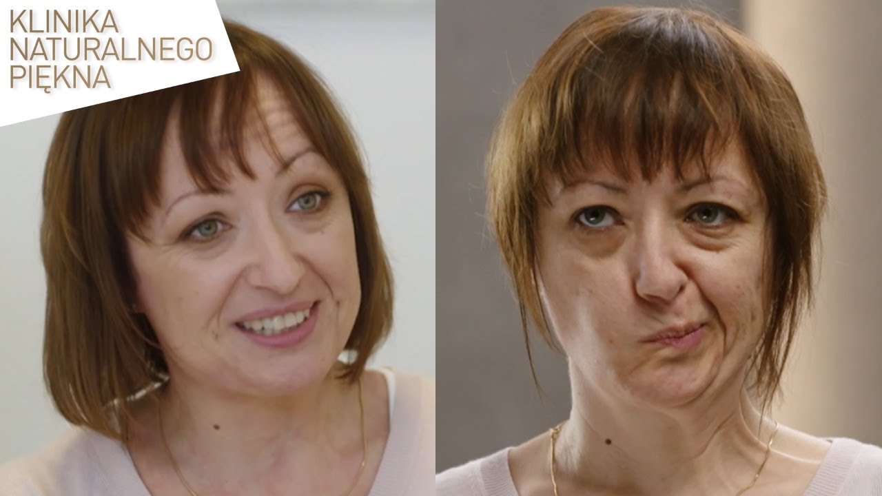 Uważa, że wygląda o 10 lat starzej i postanowiła to zmienić! [Klinika naturalnego piękna]