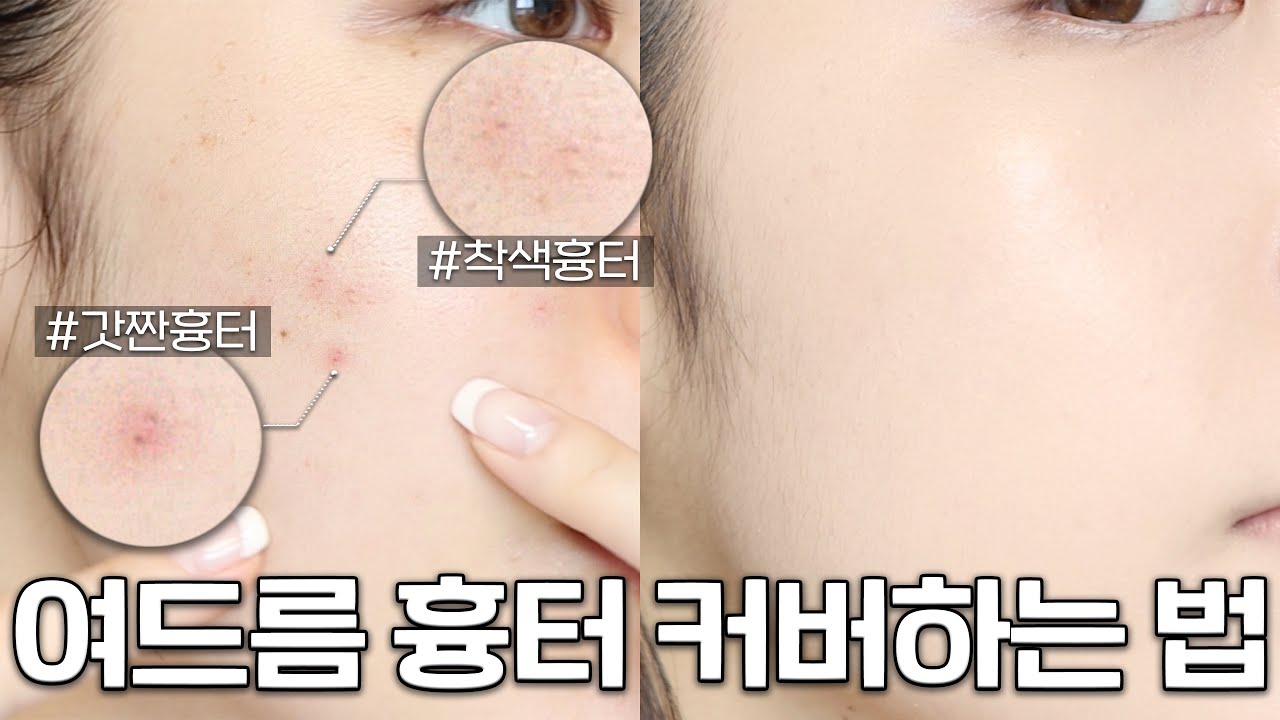 보정❌ 여드름 흉터 커버하는 방법‼️트러블 올라온 날도 깨끗한 피부 ( 트러블/색소침착/잡티 피부 커버 방법 ) + 문의 100건 컨실러 브러쉬 추천까지✨