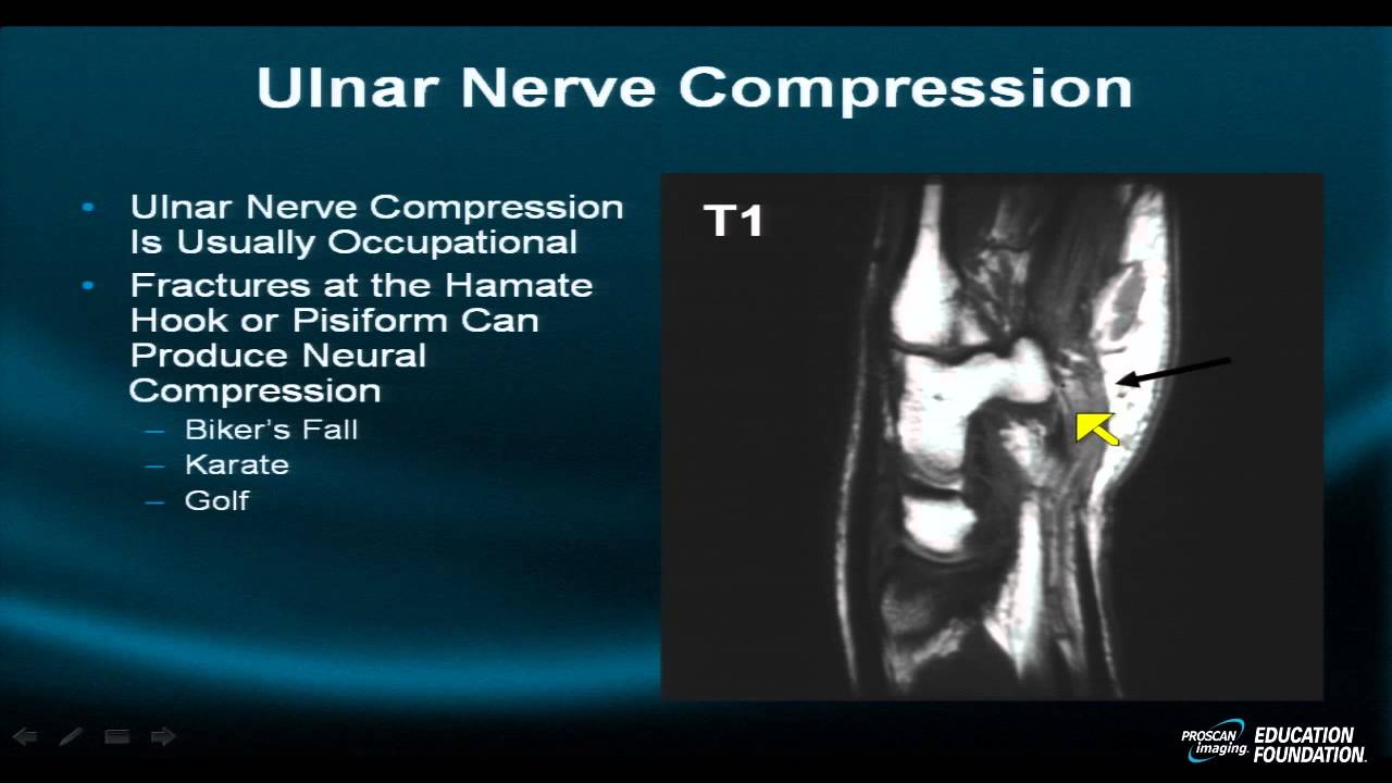 MRI Online: Wrist Part IX