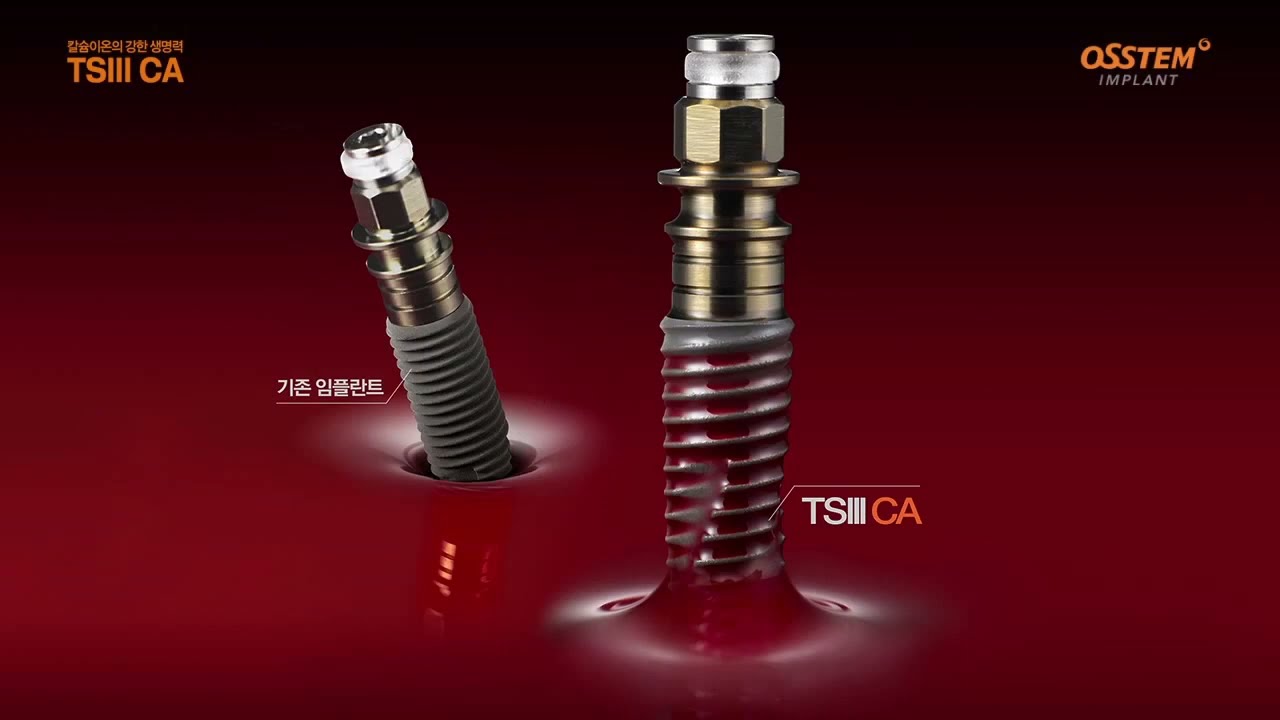 𝗢𝘀𝘀𝘁𝗲𝗺 𝗧𝗦𝗜𝗜𝗜 𝗖𝗔&reg; 𝗜𝗺𝗽𝗹𝗮𝗻𝘁