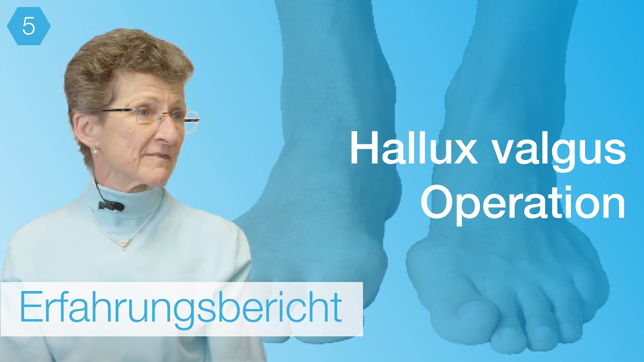 #5 Hallux heilen | Erfahrungsbericht einer Hallux OP