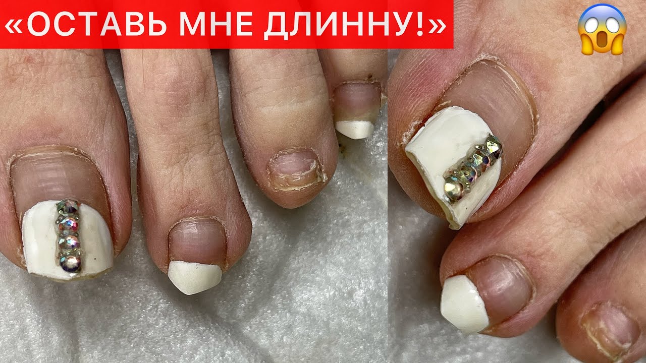 6 МЕСЯЦЕВ ПЕДИКЮРУ😱НАРАЩИВАЮ НОГТИ НА НОГАХ 🤯