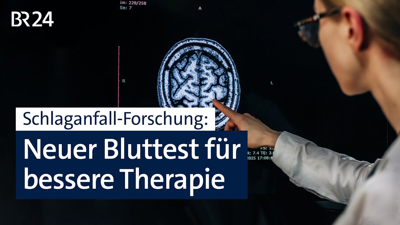 Schlaganfall-Forschung: Neuer Bluttest für bessere Therapie | BR24