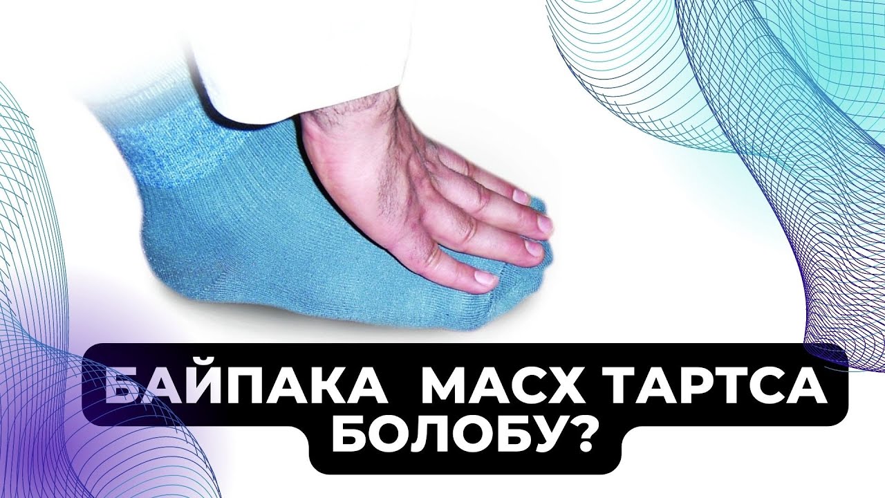 НАСКИГЕ МАСХ ТАРТСА БОЛОБУ?