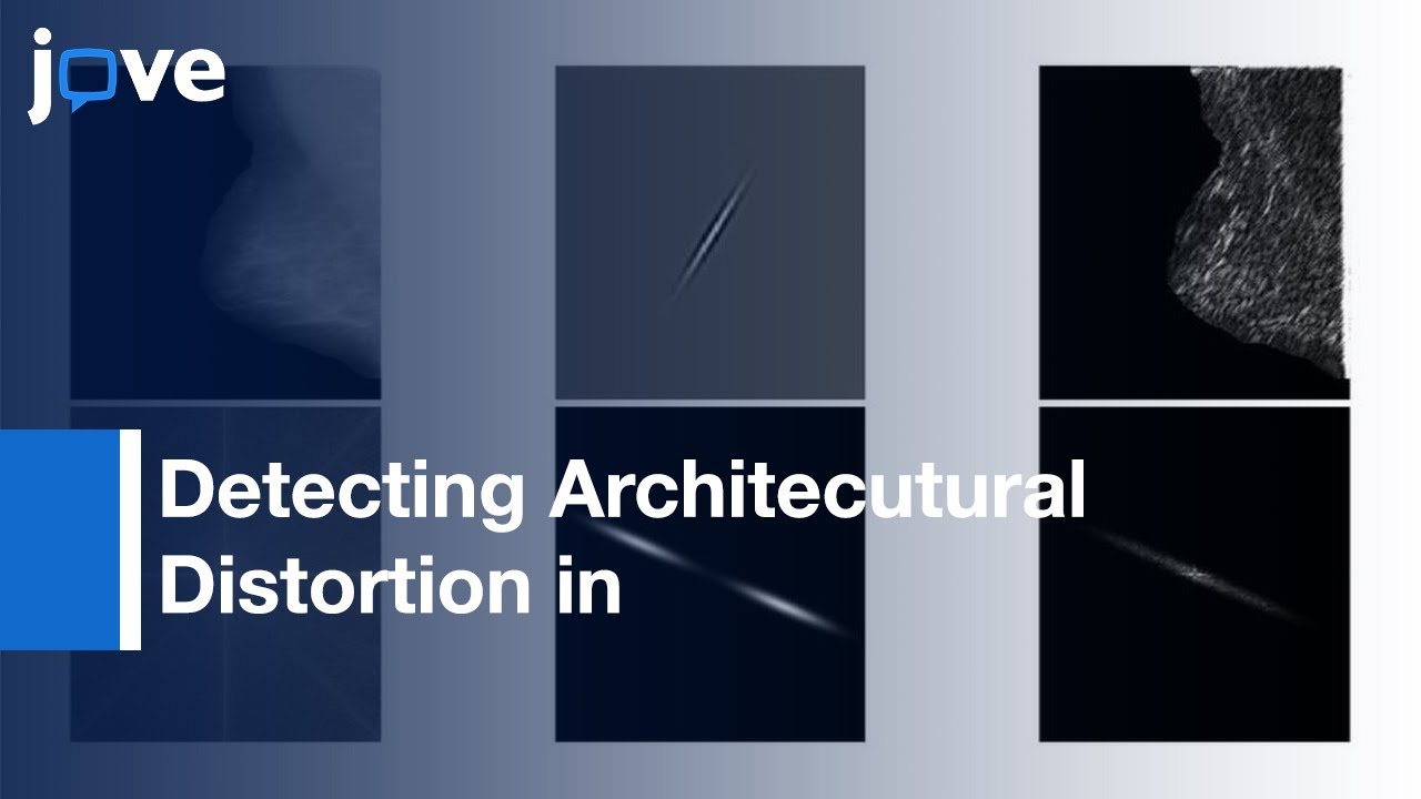 Architectural Distortion in Mammograms: Oriented patterns | Protocol Preview