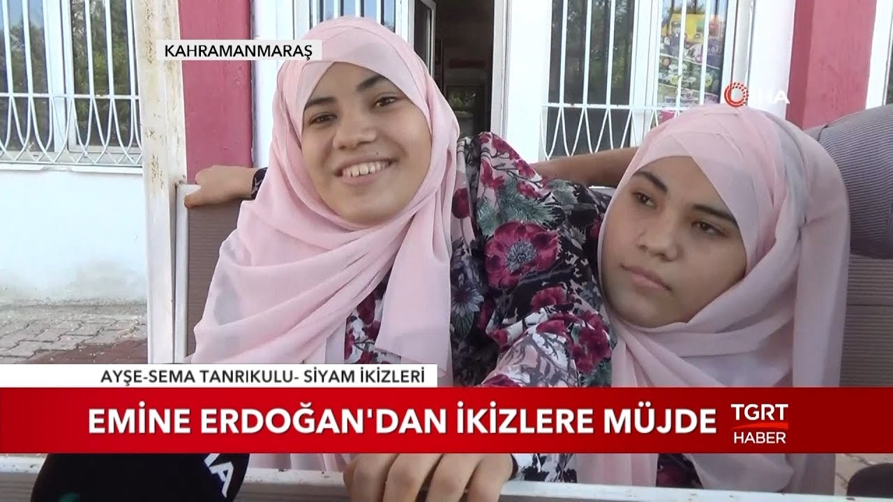 Siyam İkizleri Artık Üniversiteli