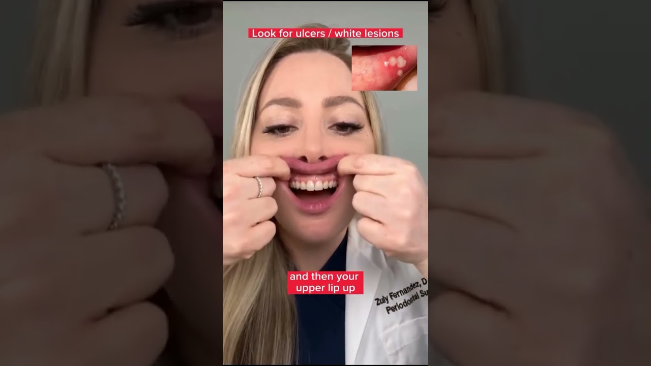Oral cancer self exam