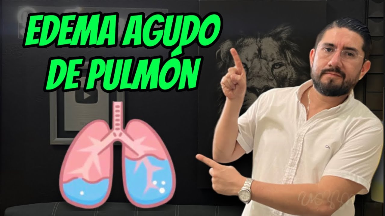 EAP Cardiogénico🫀 y No Cardiogénico 🫁 | Aprende 👨🏻‍🏫 en 5 minutos