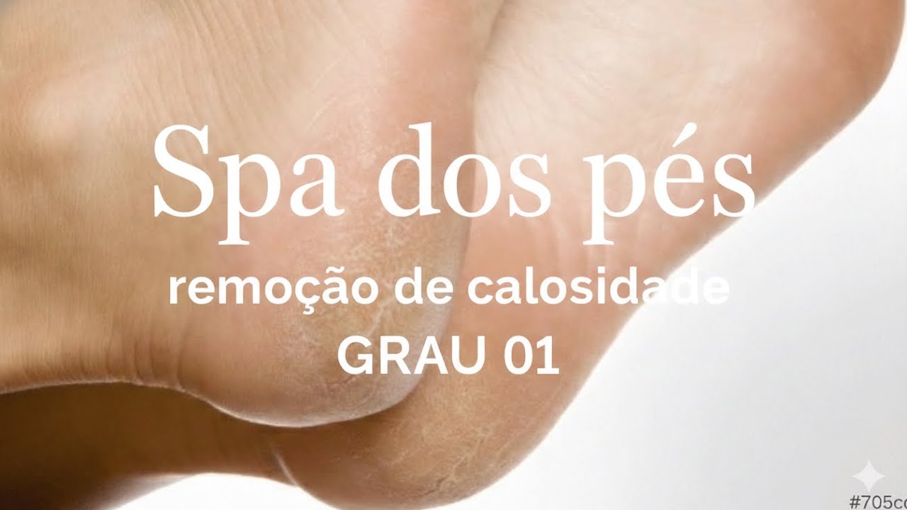Spa Dos Pés | Remoção De Calosidade Grau 01