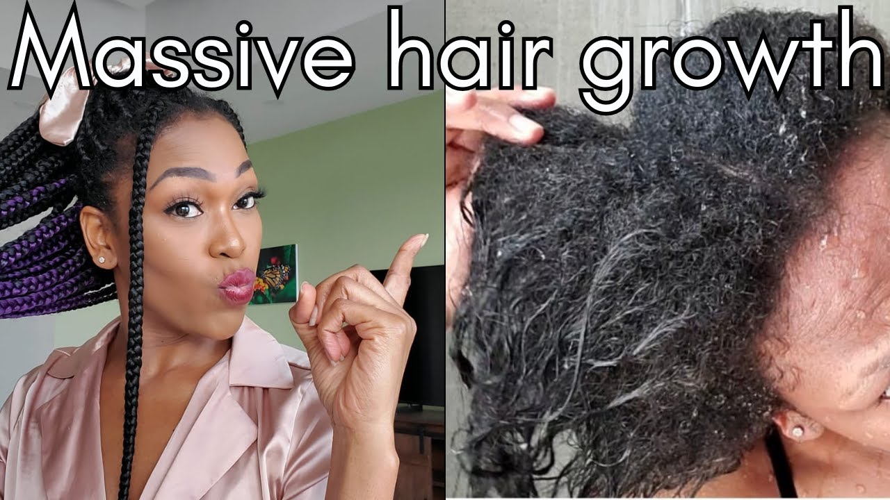 I GROW OUT MY RELAXED HAIR USING BRAIDS | Relaxed to Natural in just 8 months