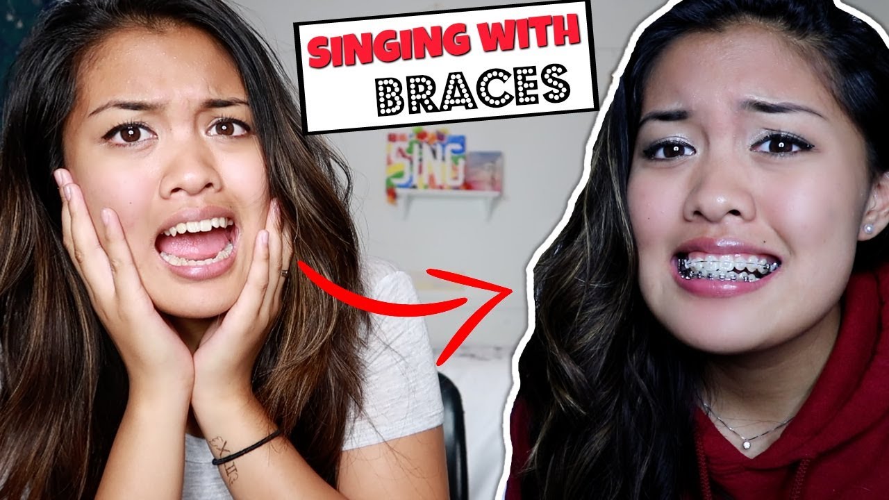 Singing With Braces vs. Singing Without Braces?