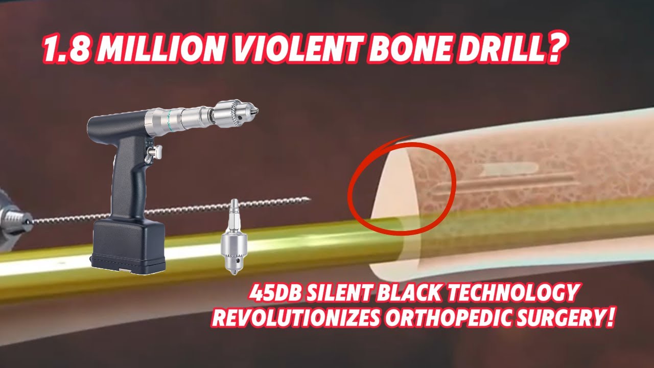 Silent Power: How a 45dB Orthopedic Drill is Transforming Operating Rooms