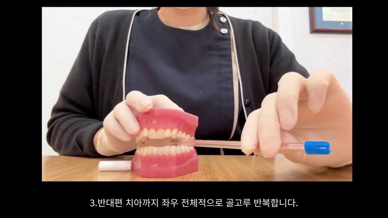 인비절라인 츄잉사용방법 #올바른츄잉사용방법 #투명교정장치츄잉 #인비절라인