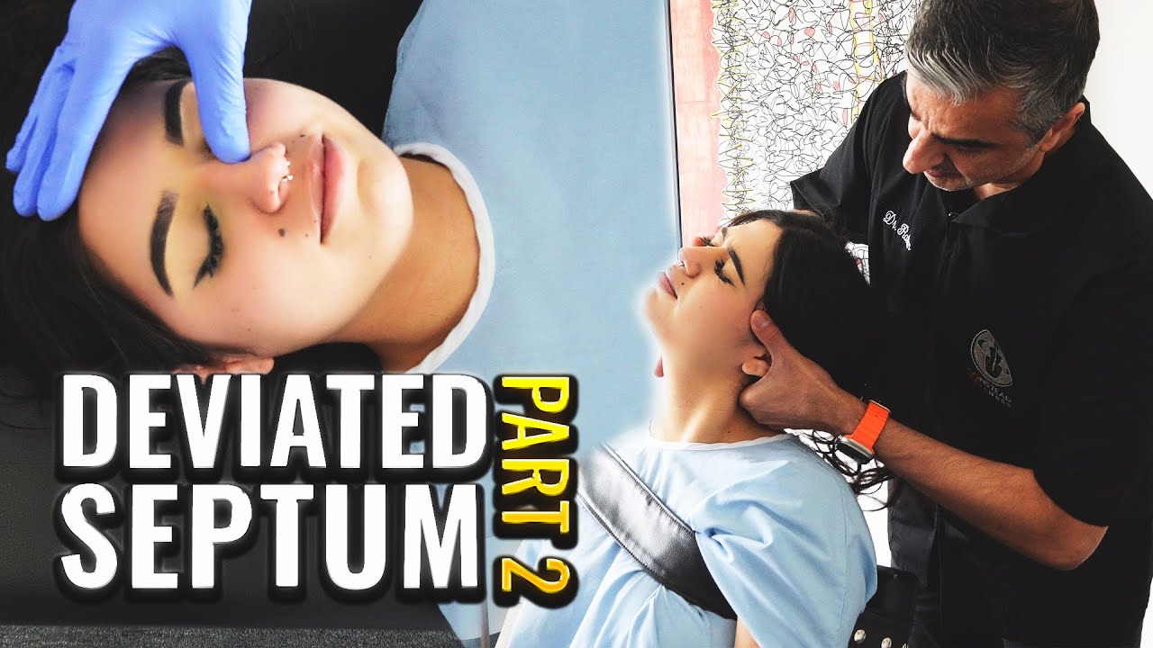 Years of difficulty breathing alleviated! Deviated Septum Adjustment Part 2 @Dr. Rahim Gonstead Chiropractor