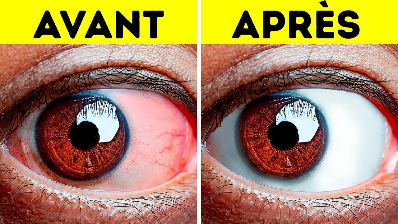10+ Exercices Simples Pour Soulager Les Yeux Fatigués