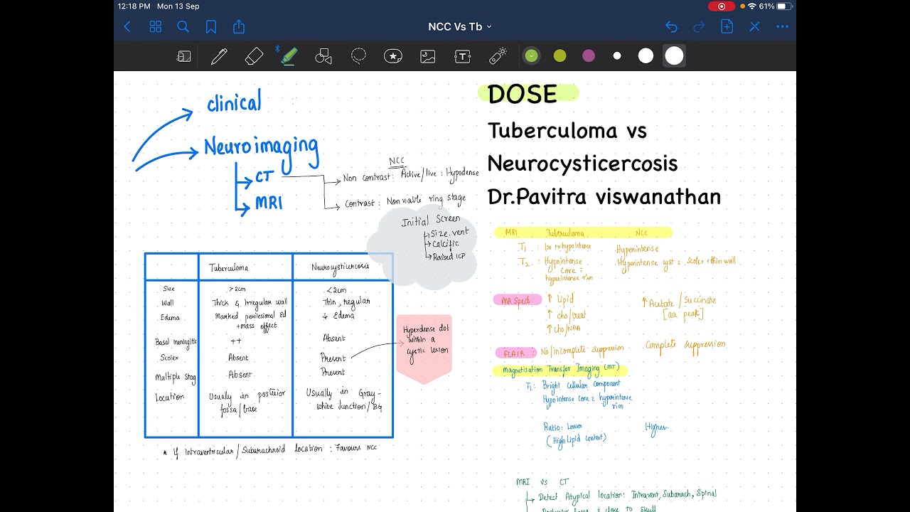 DOSE :Tuberculoma vs NCC