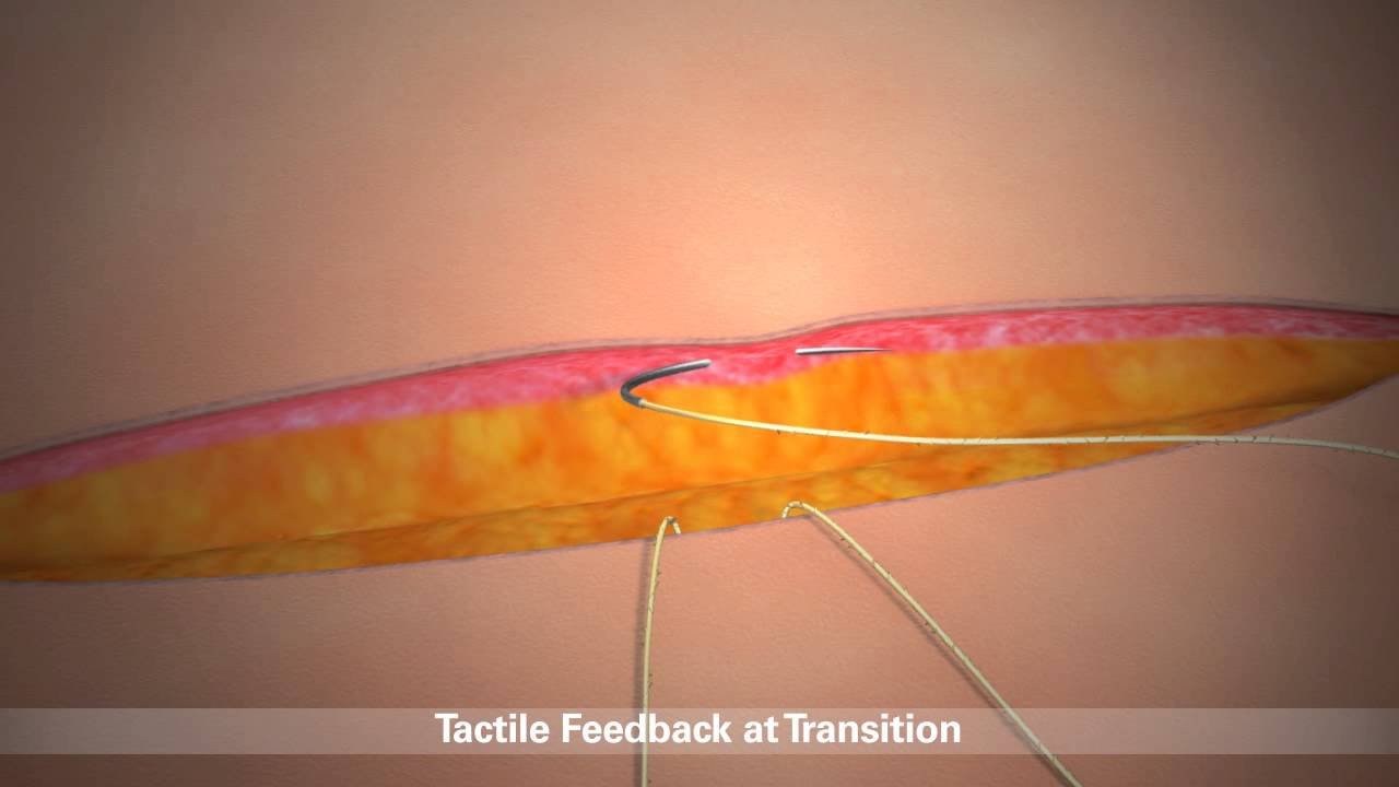 STRATAFIX Product Overview Animation CA