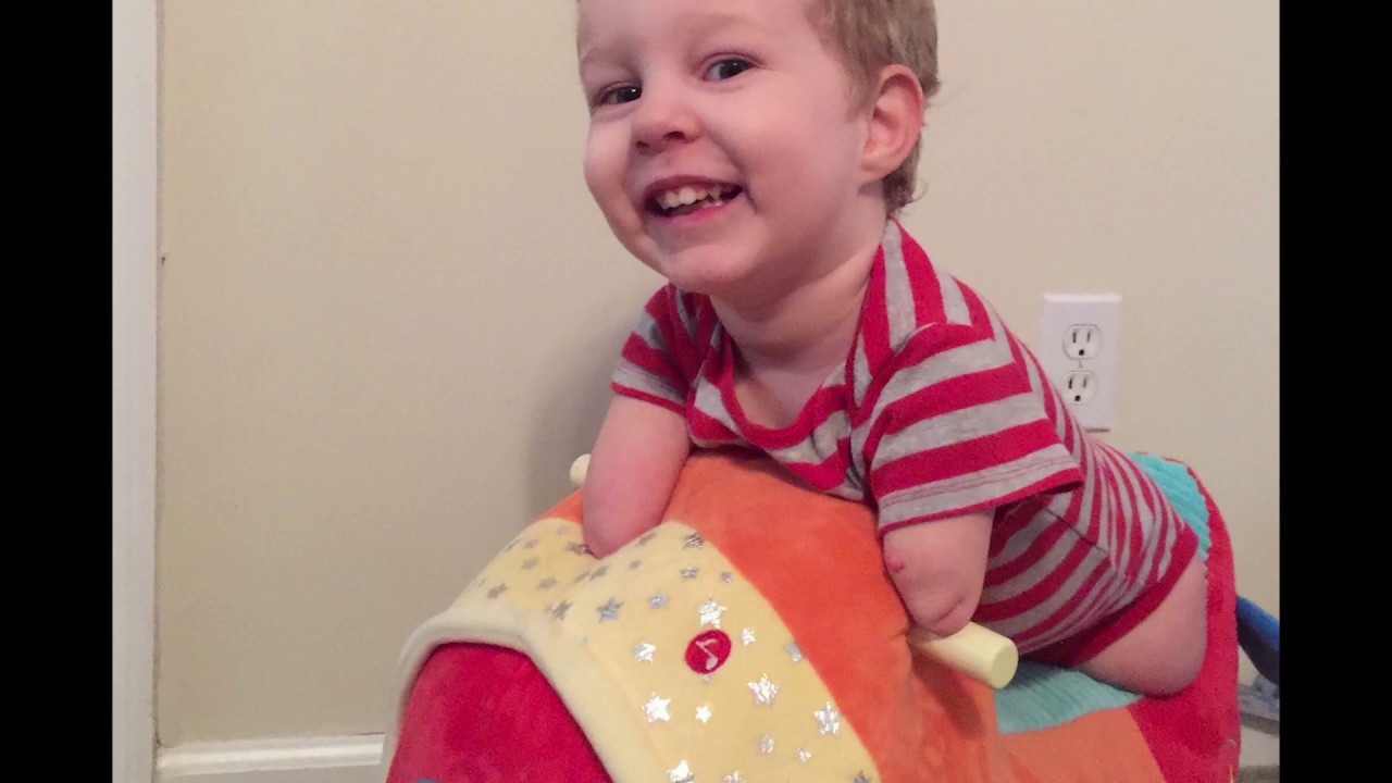 Mom raising awareness about ‘limb-different’ kids