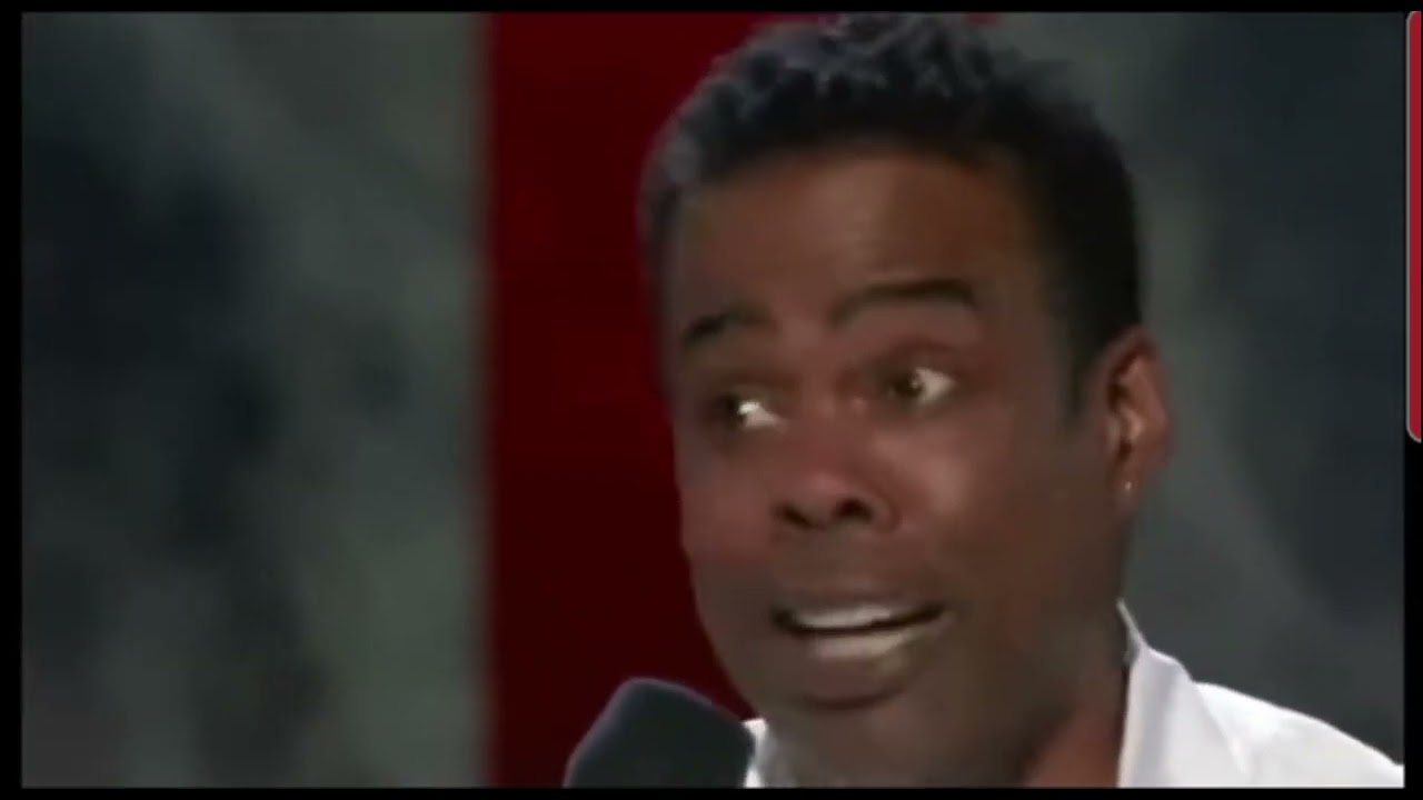 Did it hurt- Chris Rock