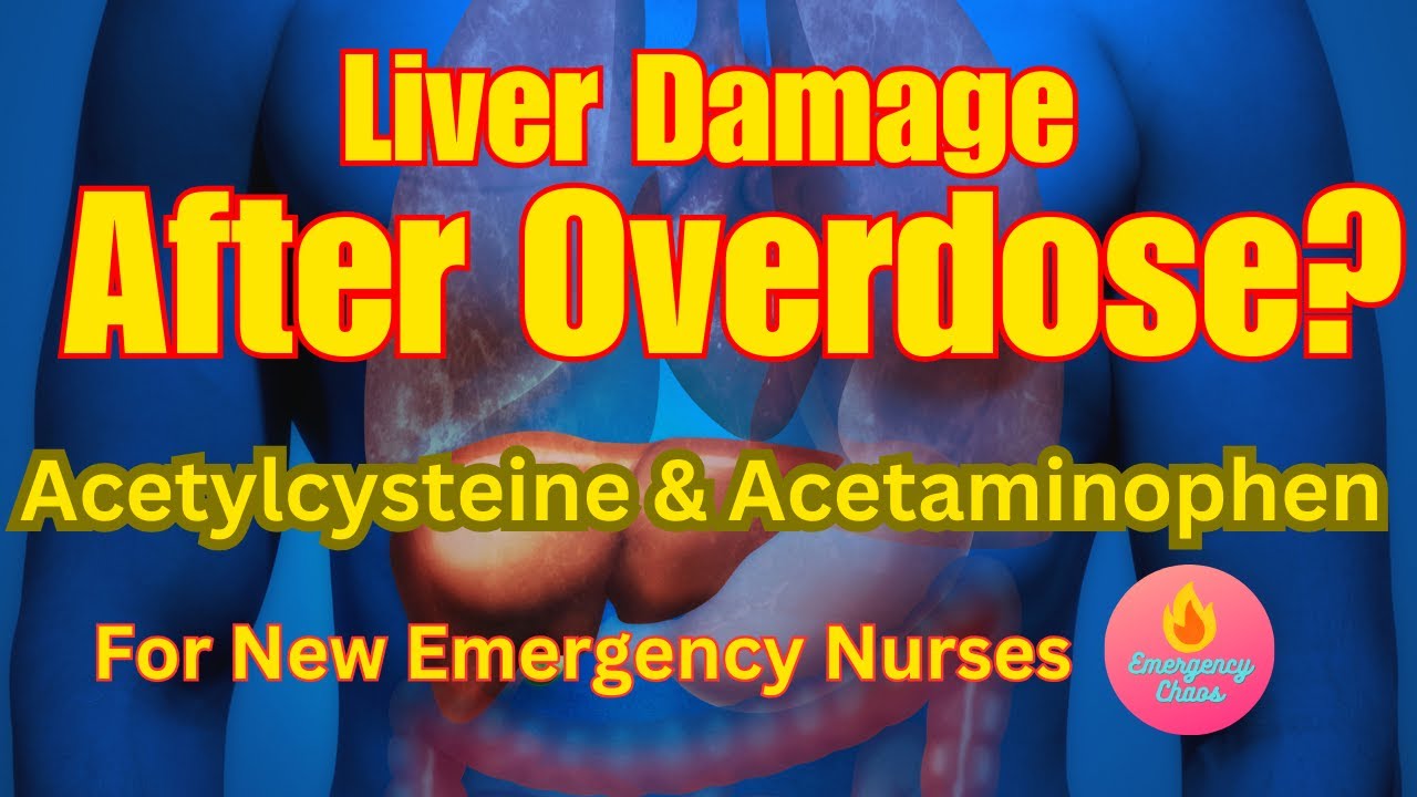 Acetaminophen Overdose & NAC: What ER Nurses Must Know!