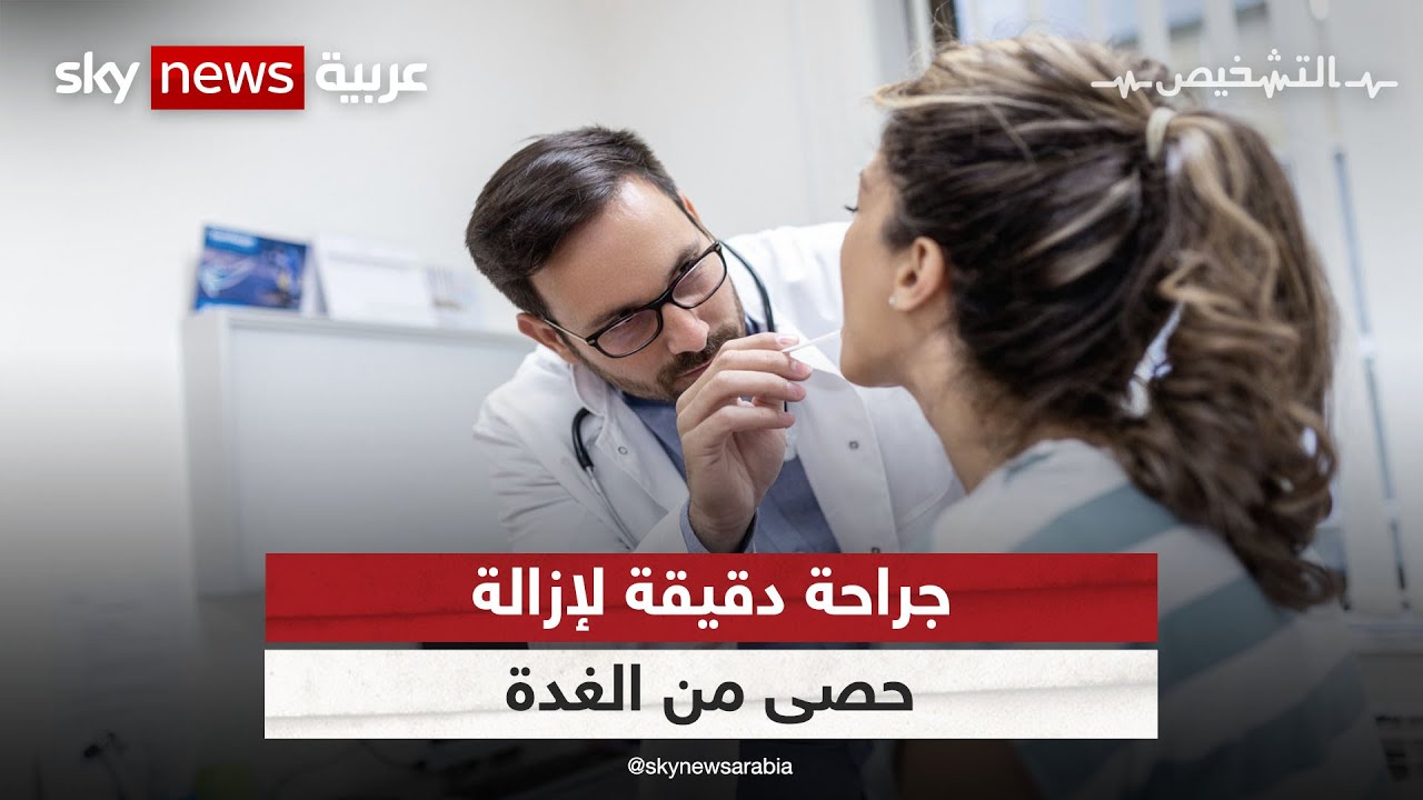 طبيب كويتي ينجح بإزالة حصى الغدة النكافية بطريقة مبتكرة | #برنامج_التشخيص