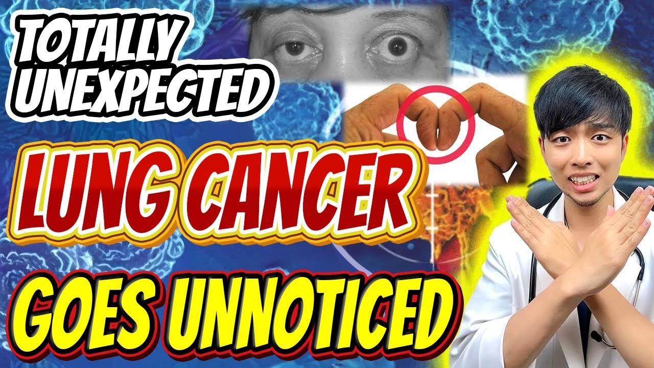 4 Warning Signs of Lung Cancer You Can't Ignore—What Doctors Want You to Know