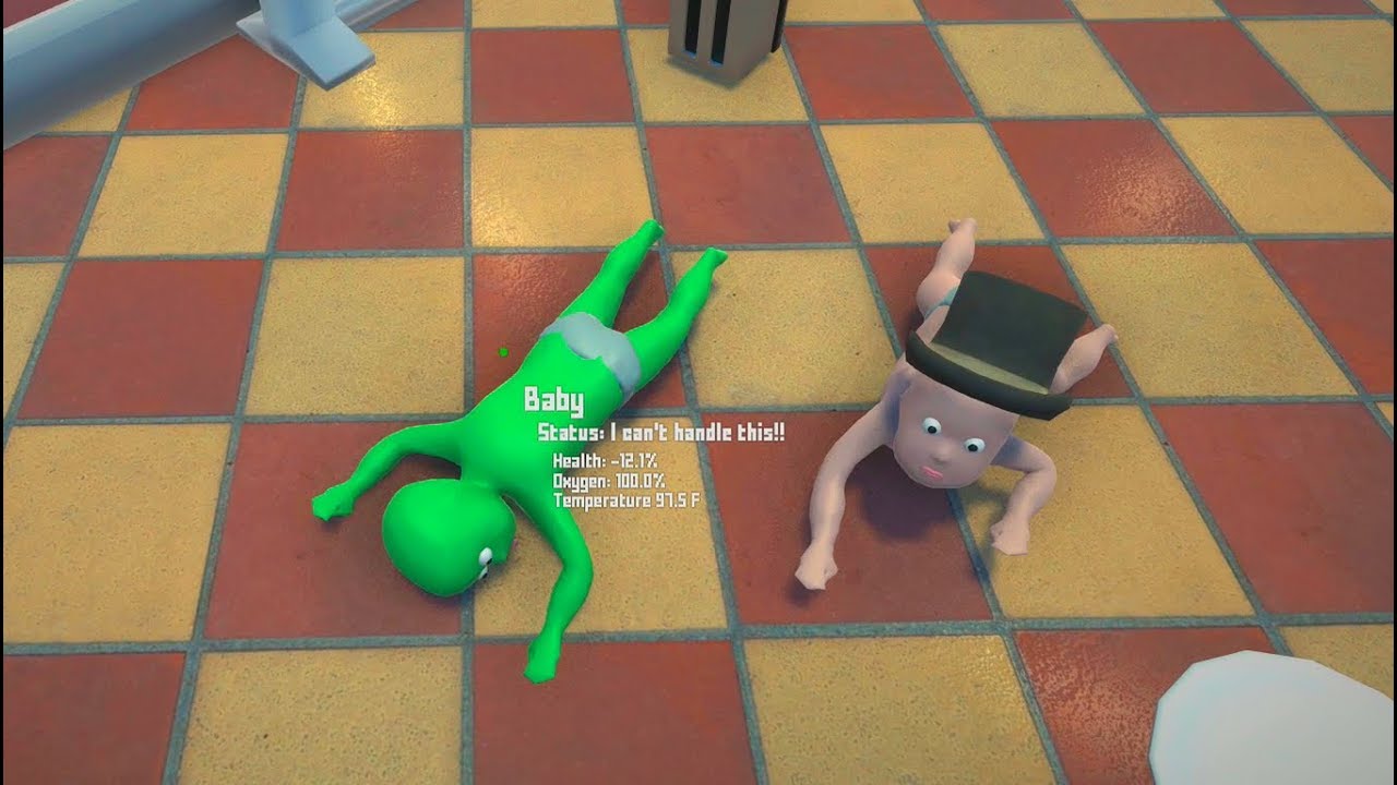 EL GEMELO QUE MURIÓ!