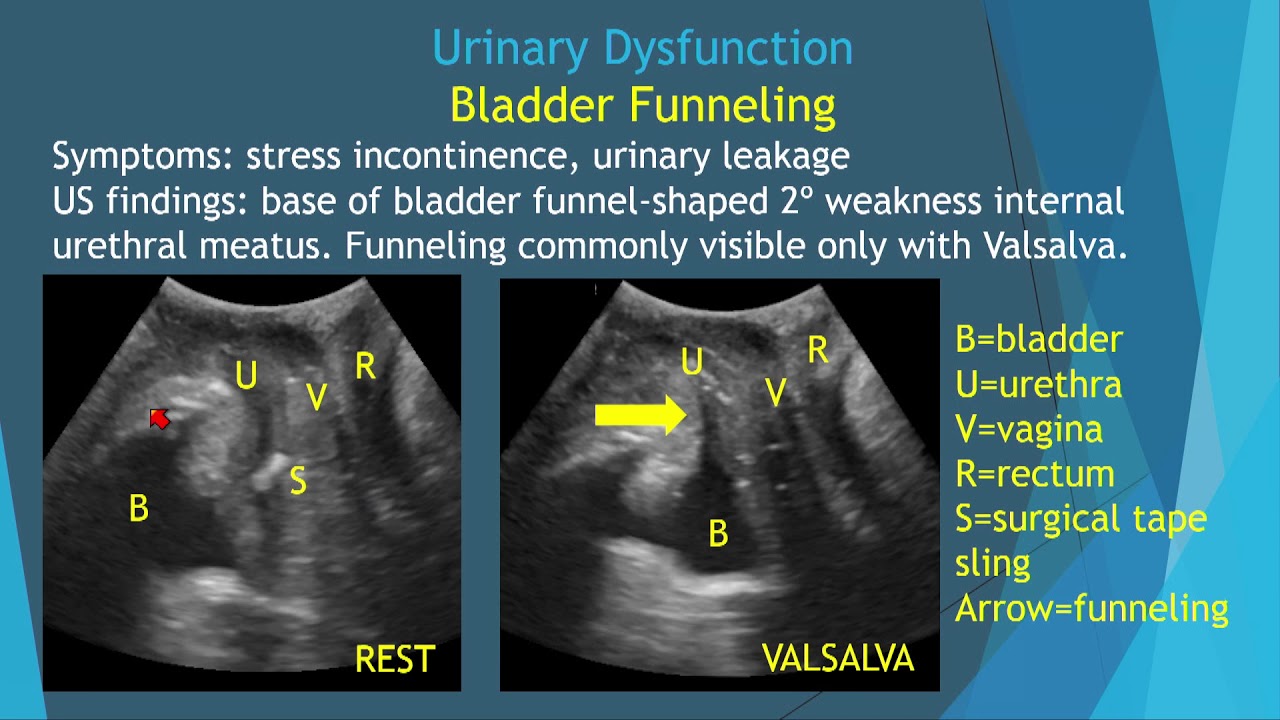 Pelvic Floor Imaging