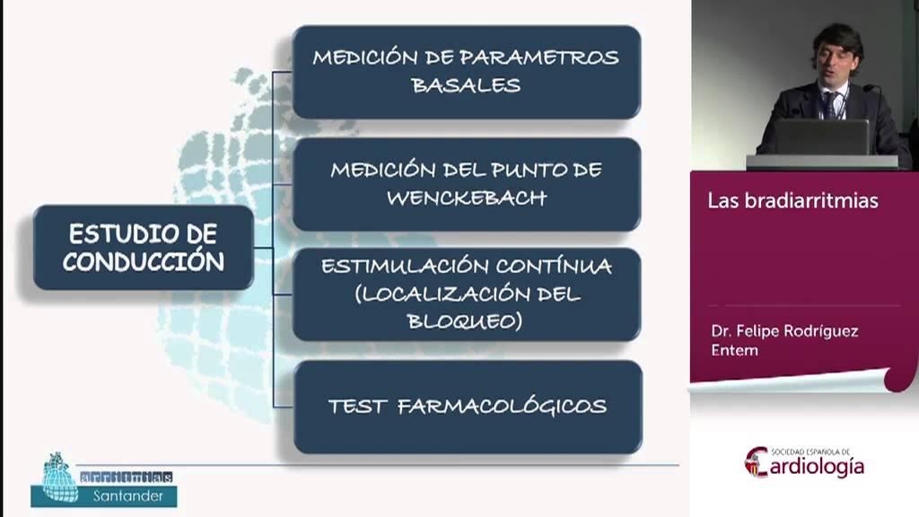 Las bradiarritmias