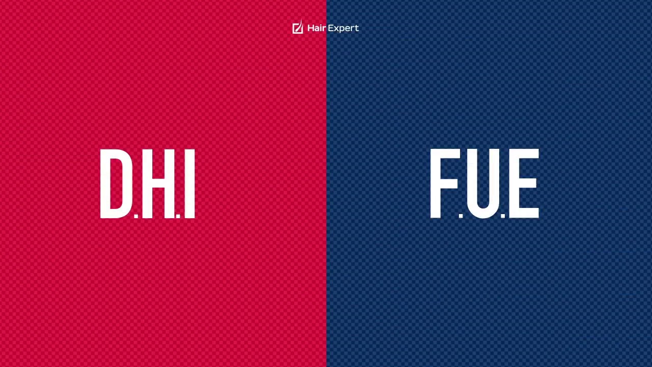 DHI vs FUE - Analogie e Differenze