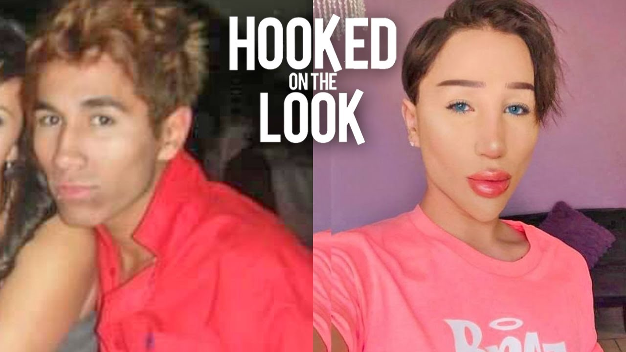 I've Had 30 Procedures - On My Face | HOOKED ON THE LOOK